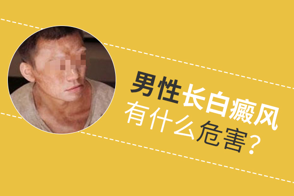 男性白癜風不治會有什么危害？